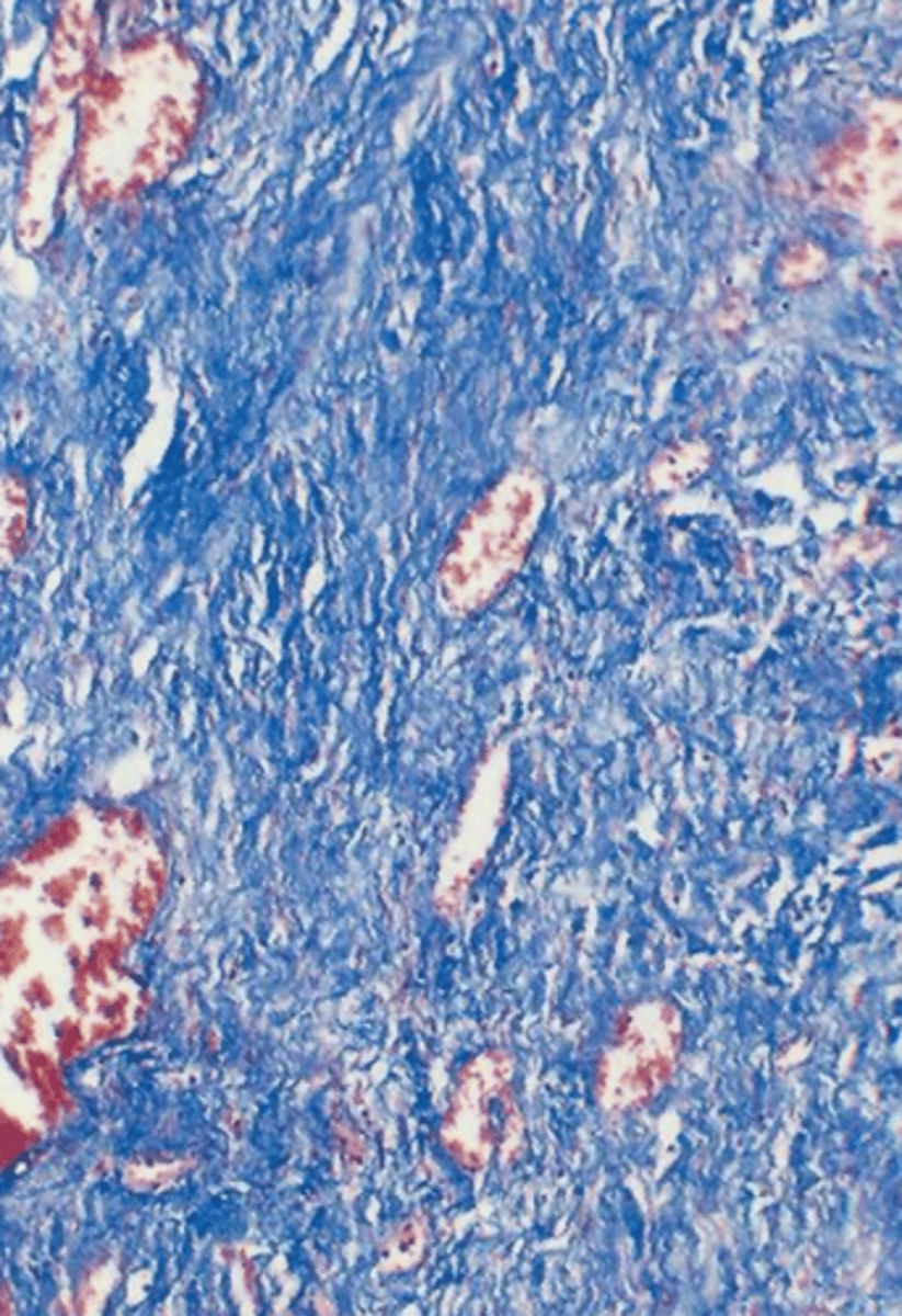 <p>what type of tissue is this?</p>