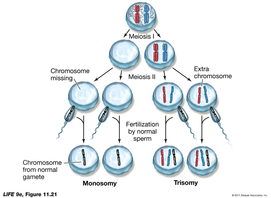 <p>Nondisjunction:</p><ul><li><p><strong>Definition</strong>: Occurs when homologous pairs fail to separate at anaphase I, sister chromatids fail to separate, or homologous chromosomes may not remain together.</p></li><li><p><strong>Result</strong>: Leads to aneuploidy, where chromosomes are either lacking or present in excess.</p><ul><li><p><strong>Cause</strong>: May be due to a lack of cohesins that hold the homologous pairs together.</p></li><li><p><strong>Outcome</strong>: Without cohesins, both homologs may go to the same pole, resulting in gametes with two of the same chromosome or none.</p></li></ul></li></ul><p>Aneuploidy in Humans:</p><ul><li><p><strong>Trisomy 21</strong>:</p><ul><li><p>If both chromosome 21 homologs go to the same pole and the resulting egg is fertilized, the zygote will be trisomic for chromosome 21, leading to Down syndrome.</p></li><li><p><strong>Monosomy</strong>: A fertilized egg that did not receive a copy of chromosome 21 will be monosomic, which is lethal.</p></li></ul></li><li><p><strong>Translocation</strong>:</p><ul><li><p>A piece of chromosome may break away and attach to another chromosome.</p></li><li><p>Individuals with a translocated piece of chromosome 21 plus two normal copies will have Familial Down syndrome.</p></li></ul></li></ul><p>Common Occurrences:</p><ul><li><p><strong>Trisomies and Monosomies</strong>:</p><ul><li><p>Common in human zygotes, but most embryos with these conditions do not survive.</p></li><li><p>Trisomies and monosomies for chromosomes other than 21 are typically lethal and cause many miscarriages.</p></li></ul></li></ul><p>Polyploidy:</p><ul><li><p><strong>Definition</strong>: Organisms with complete extra sets of chromosomes.</p></li><li><p><strong>Types</strong>:</p><ul><li><p><strong>Triploid (3n)</strong>, <strong>tetraploid (4n)</strong>, and even higher ploidy levels.</p></li></ul></li><li><p><strong>Mitosis and Meiosis</strong>:</p><ul><li><p>Mitosis can occur because each chromosome behaves independently.</p></li><li><p>Polyploidy can prevent meiosis as not all chromosomes will have a homolog, preventing anaphase I.</p></li></ul></li><li><p><strong>Applications</strong>:</p><ul><li><p>Polyploidy can enhance crop plants.</p></li><li><p>Triploidy is used to produce sterile trout for stocking rivers. </p></li></ul></li></ul><p></p>