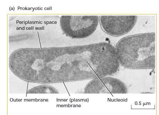 <p>prokaryotic cell (Transmission Electron Micrograph)</p>