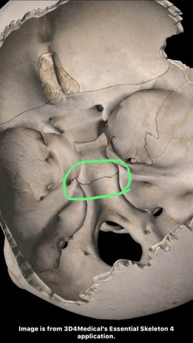 knowt flashcard image