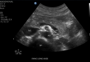 <p>transverse position w head neck body</p>