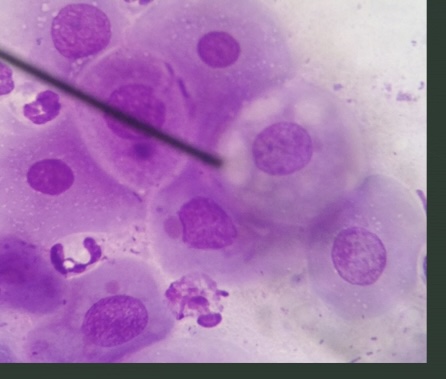 <p>What cell dis</p>