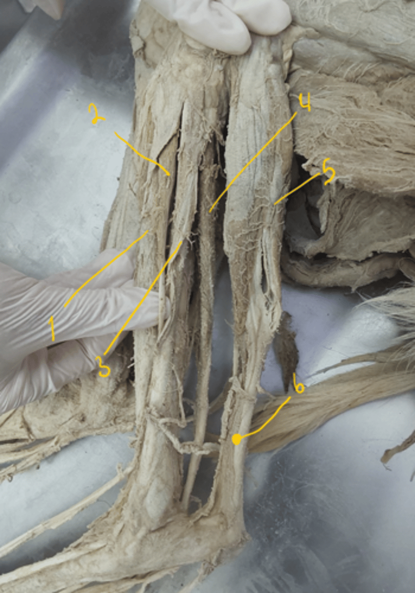 <p>identify the muscles.</p>