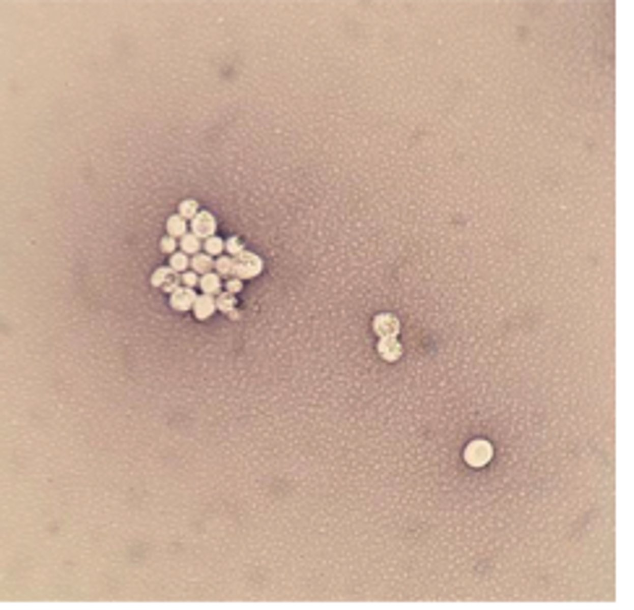 <p>A cat presents with chronic nasal discharge, polyp-like mass, and weight loss.</p><p>India ink stain</p><p>Ddx: and what feature of this yeast allows for repelling the ink ?</p>