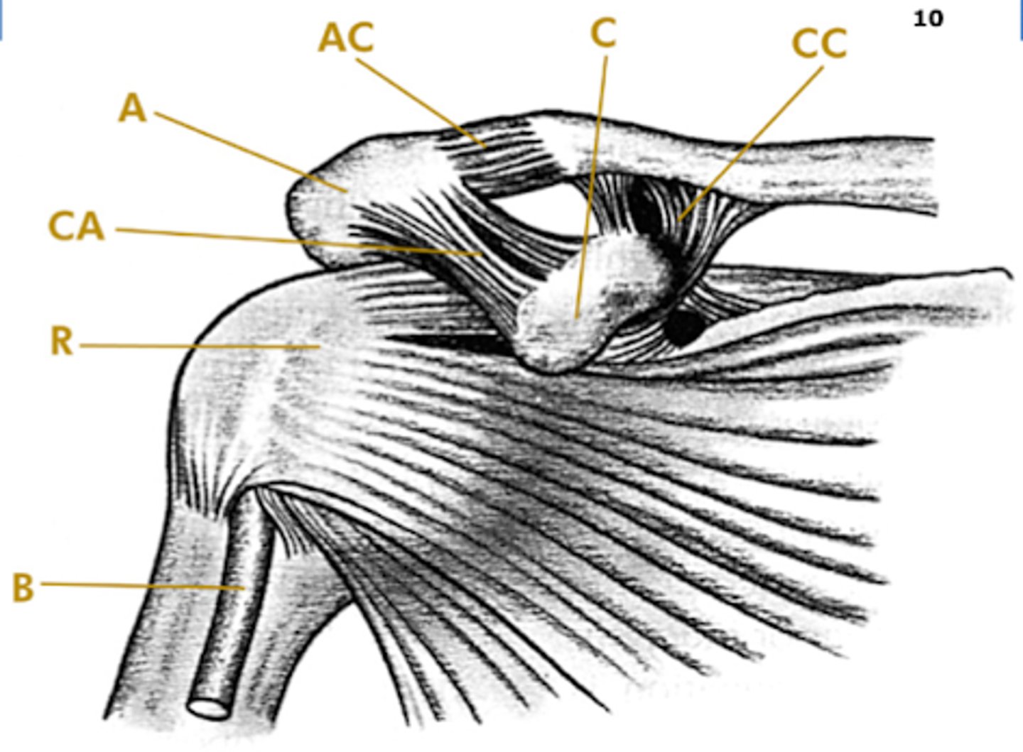 <p>B → Long head biceps</p><p>CC → coracoclavicular ligaments</p><p>A → acromion</p><p>C → coracoid process</p><p>CA → coracoacromial ligament</p><p>AC → acromioclavicular joint capsule</p>