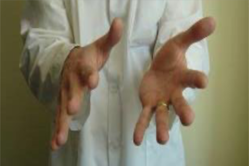 <p>Identify the Cranial Strain Pattern:</p>