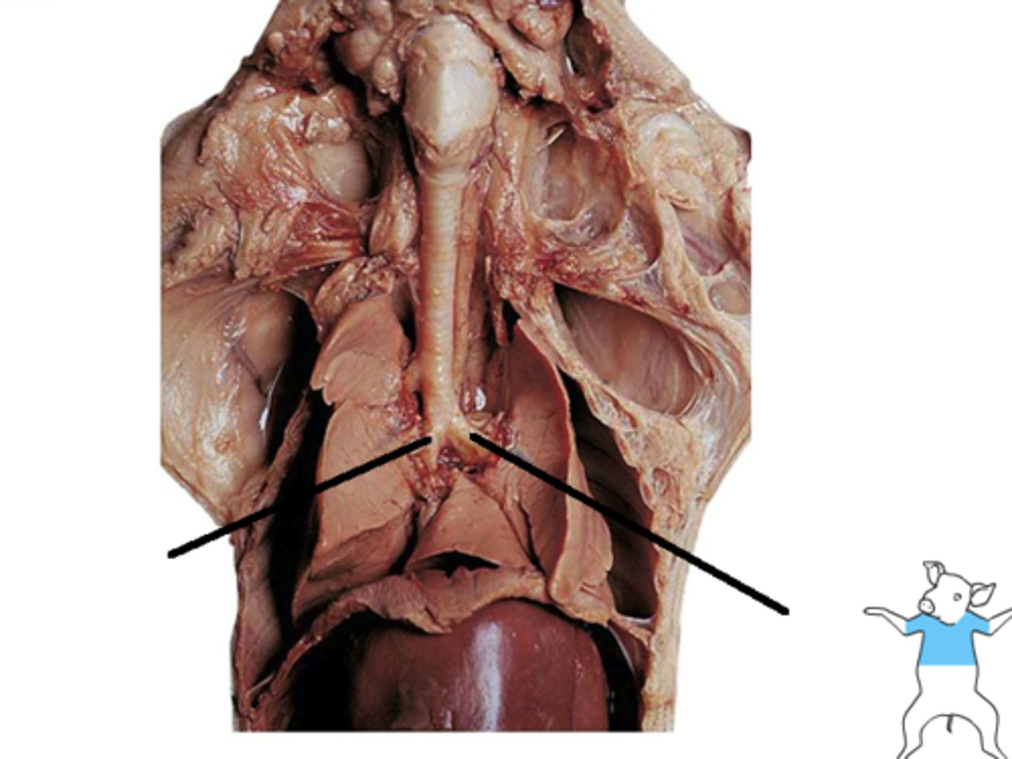 <p>Main air passages branching from trachea.</p>