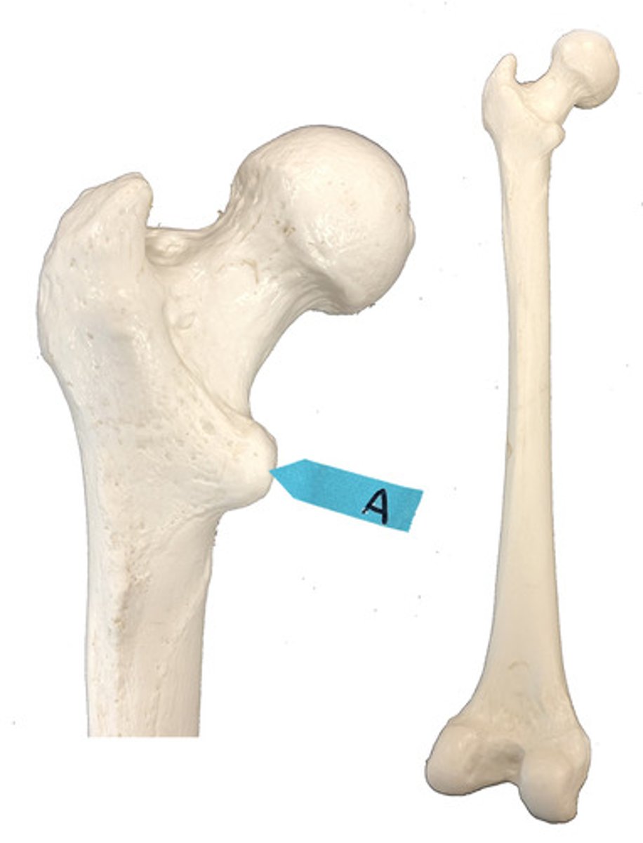 <p>Identify this bone marking.</p>
