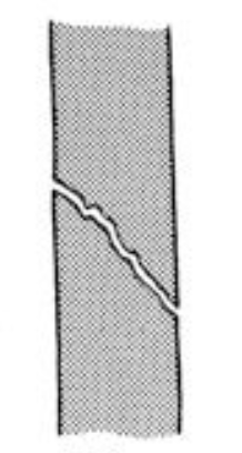 <p>What classification of fracture is this?</p>