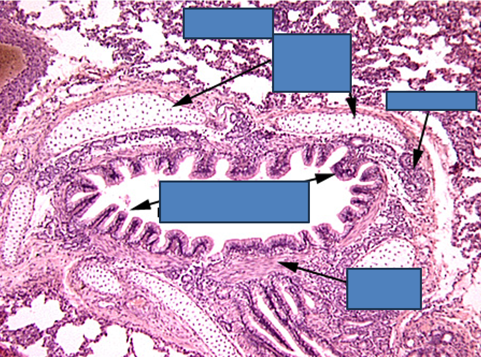 <p>Identify this structure</p>