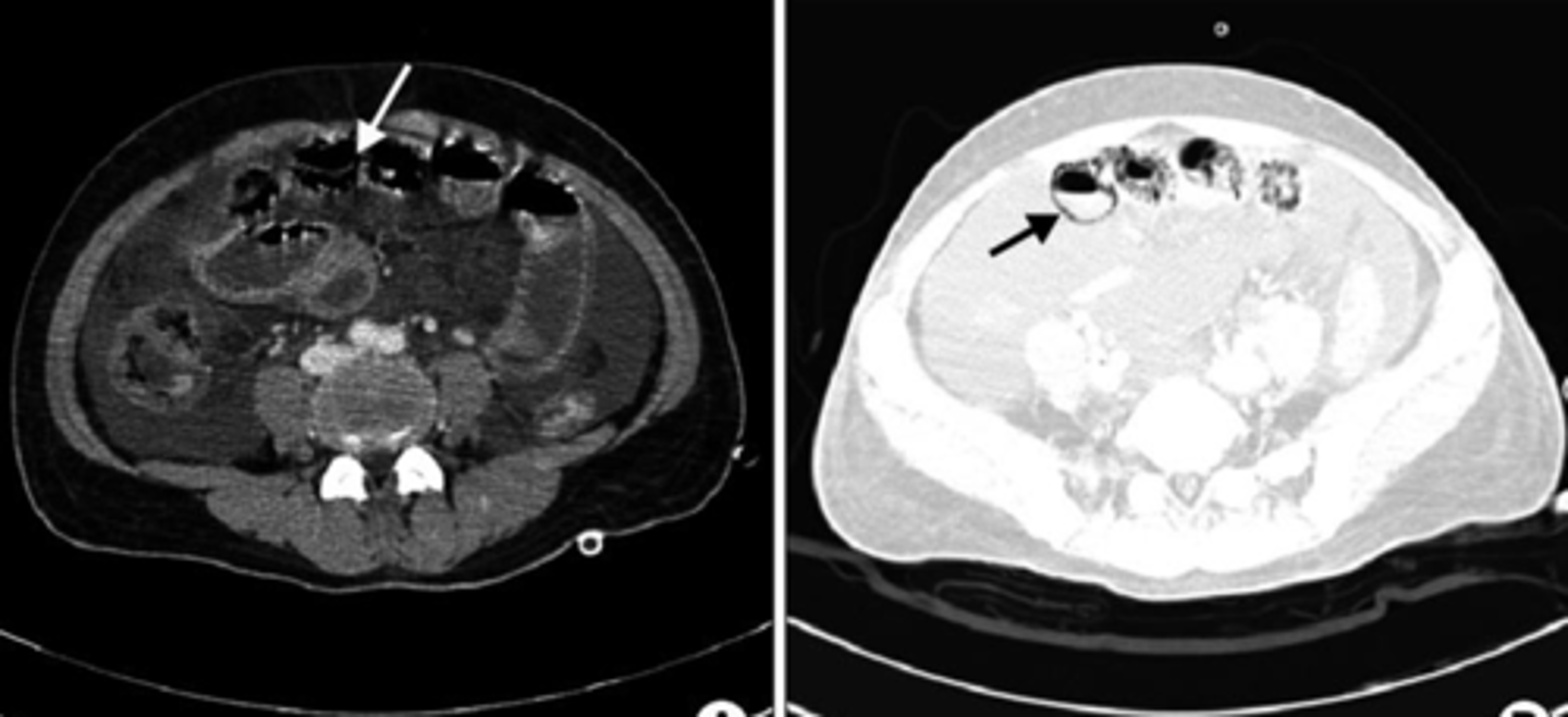 <p>What pathology is being depicted here?</p>