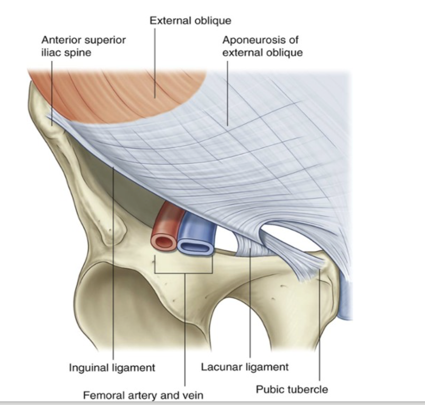 <p>Ligaments that are extensions of fibers at medial end of inguinal canal (associated abdominal ligaments)</p>
