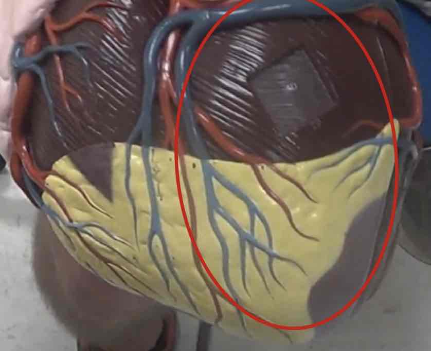 <p>what is this? (giant heart model)</p>