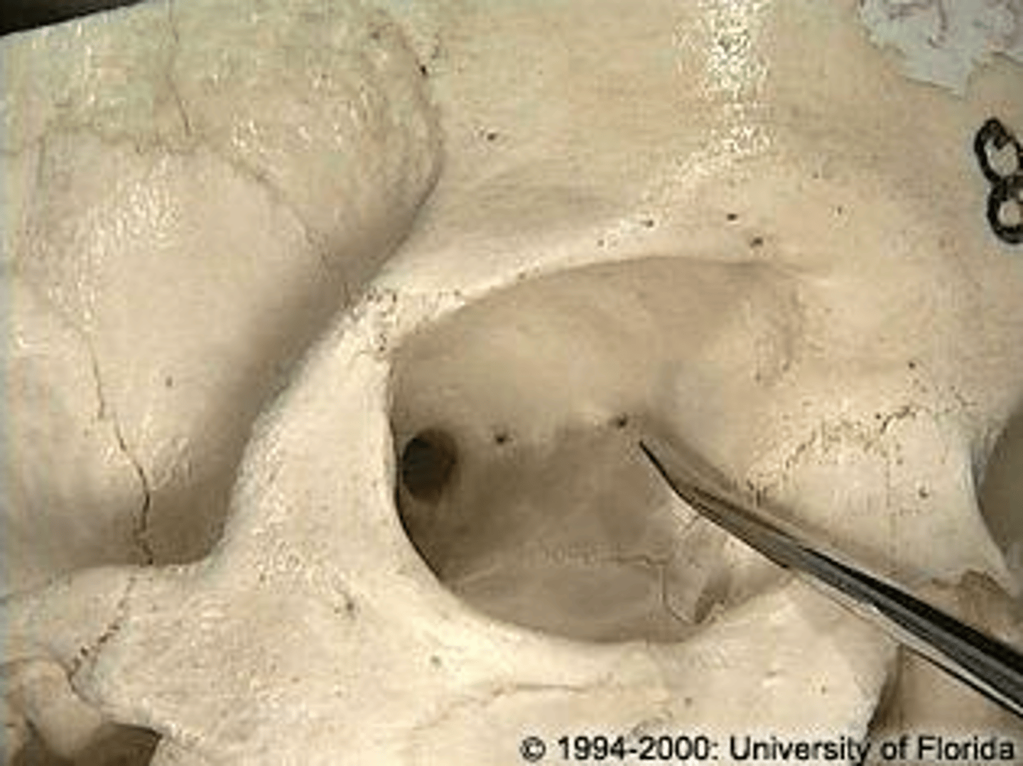 <p>Opening for ethmoidal nerves and vessels.</p>