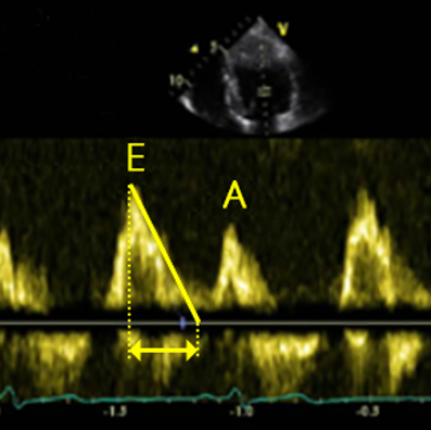 <p>time from flow peak to end of flow</p>