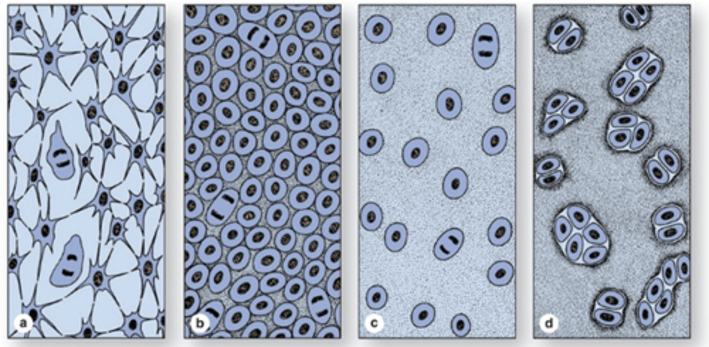 <p>What are the steps of cartilage formation (condrogenesis)? (4)</p>