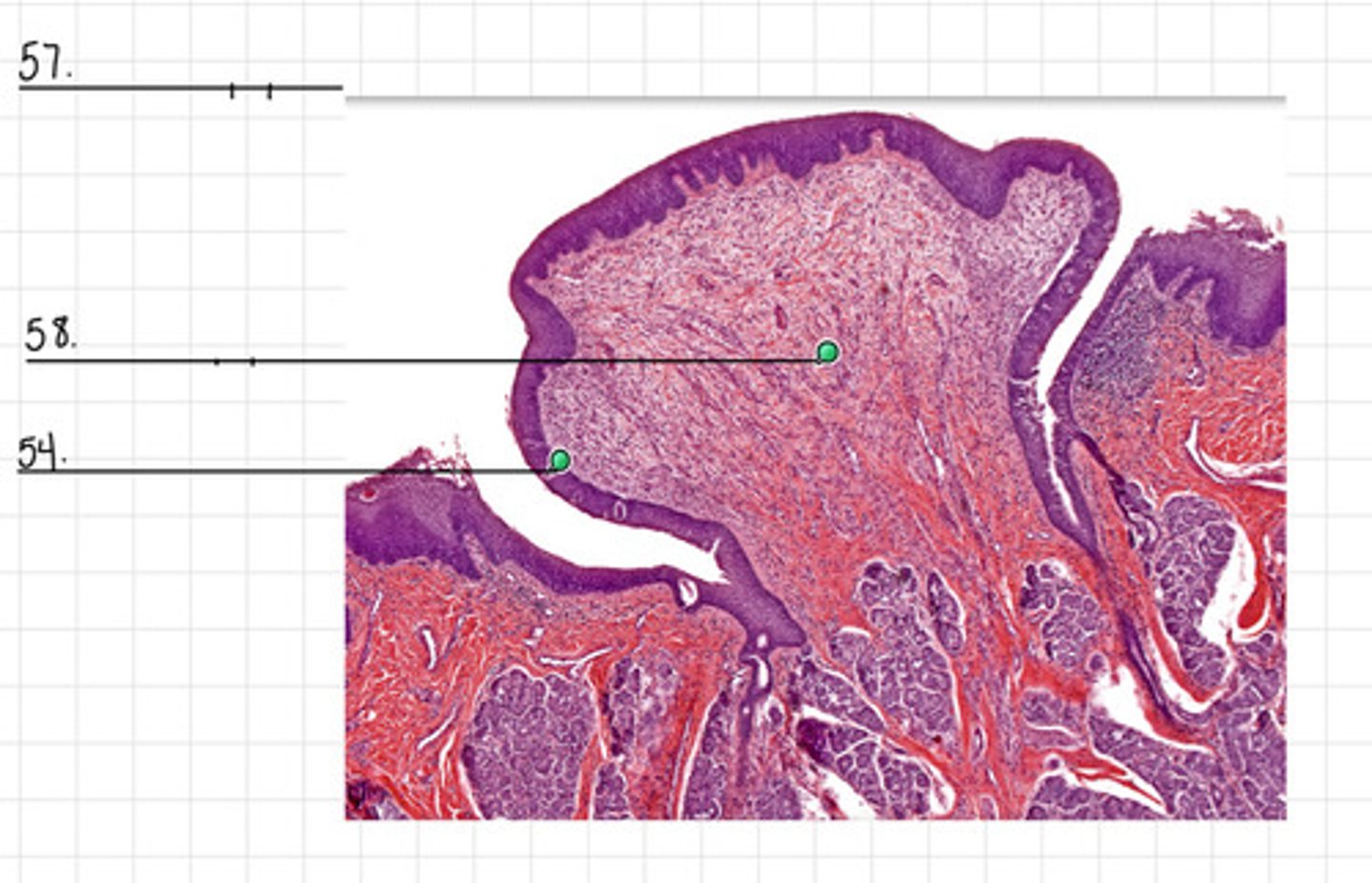 <p>57</p>