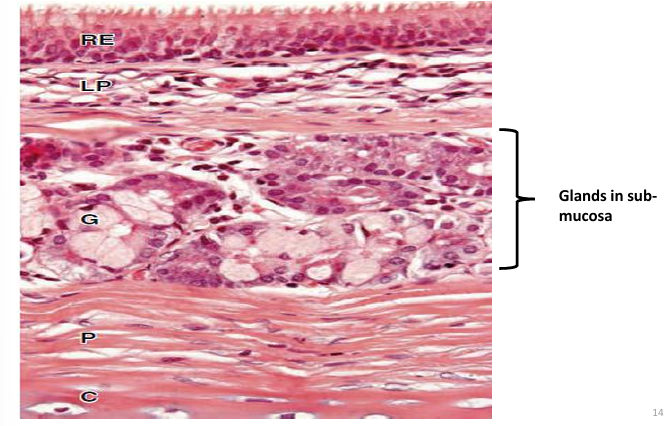 <p><br><strong>Trachea</strong></p>