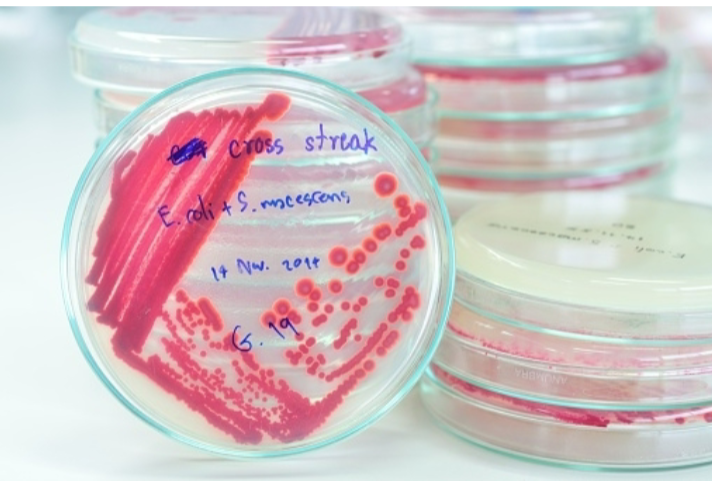 <p>Where do used agar plates and test tubes go after incubation?<br></p>