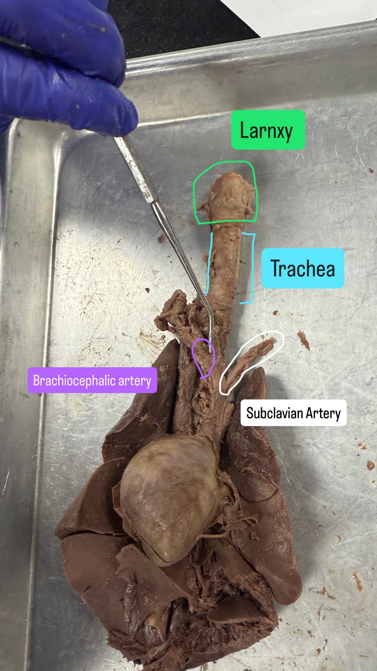 <p>Subclavian artery, Brachiocephalic artery (<mark data-color="rgba(0, 0, 0, 0)" style="background-color: rgba(0, 0, 0, 0); color: inherit;">BRA-key-oh-suh-FAL-ik), Larynx (</mark>LARR-inks), Trachea</p>