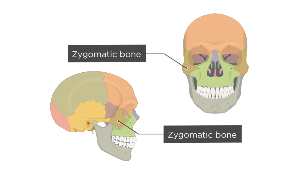 <p>[BONES TO KNOW; facial] cheek bone, protection of the eye</p>
