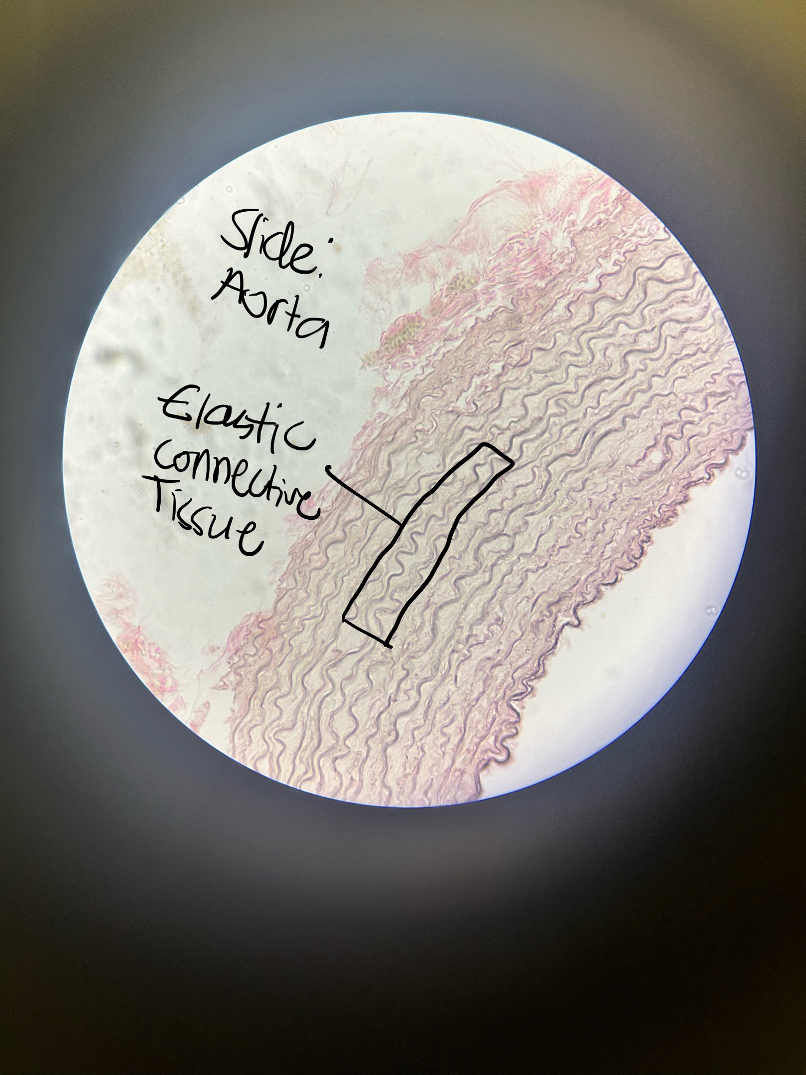 <p>Dense Connective Tissue: Elastic CT Location and Function </p>