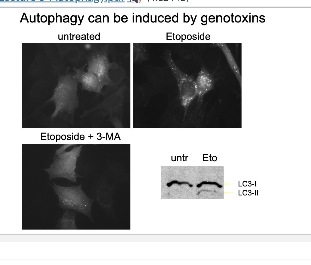 <ul><li><p>Eto increases LC3-II (membrane bound form)→ confirming autophagy induction</p></li><li><p>Eto treated cells show many brigh LC3-puncta → autophagosomes forming in response to DNA damage</p></li><li><p>eto + 3-MA → fewer LC3 puncta → 3MA inhibits autophagy by blocking class III PI3K</p></li></ul><p></p>