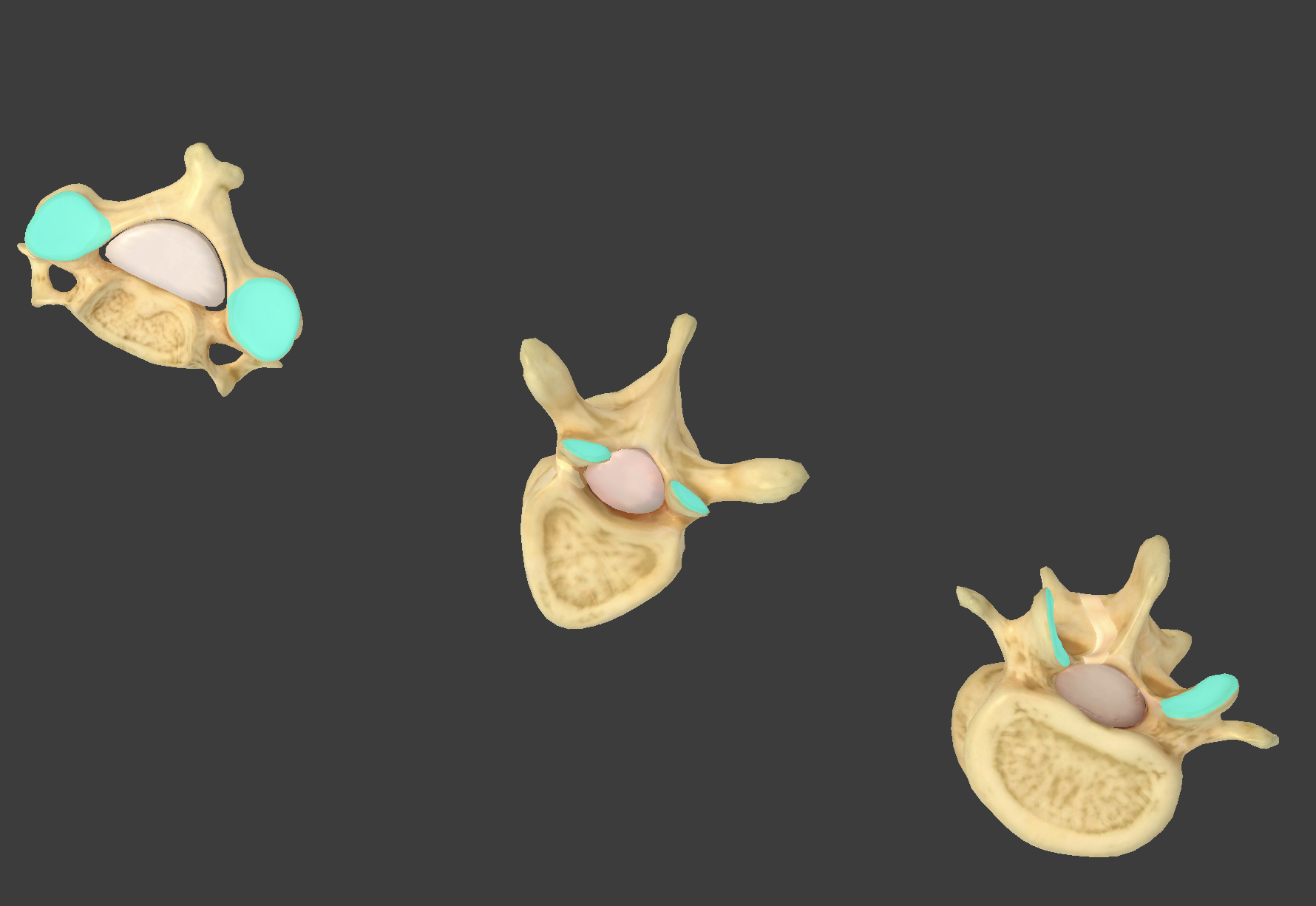 <p>what component of vertebrae is this?</p>