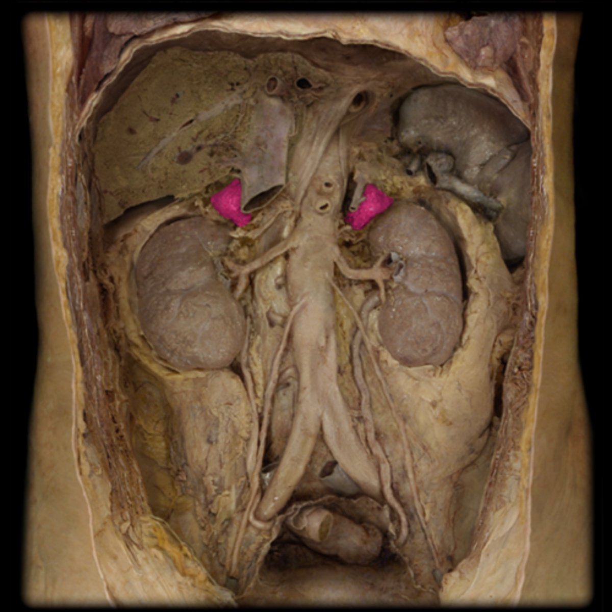 <p>Description: Small, pyramidal-shaped tissues with a bumpy texture</p><p>Location: Located on the superior aspect of kidneys</p>