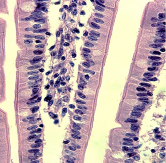 <p>Células epiteliales glandulares caliciformes asociadas al epitelio </p>