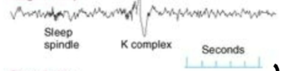 <p>what sleep stage is  this EEG recording?</p>