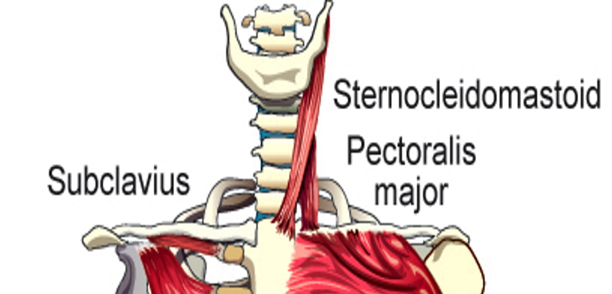 <p>Sternocleidomastoid </p>