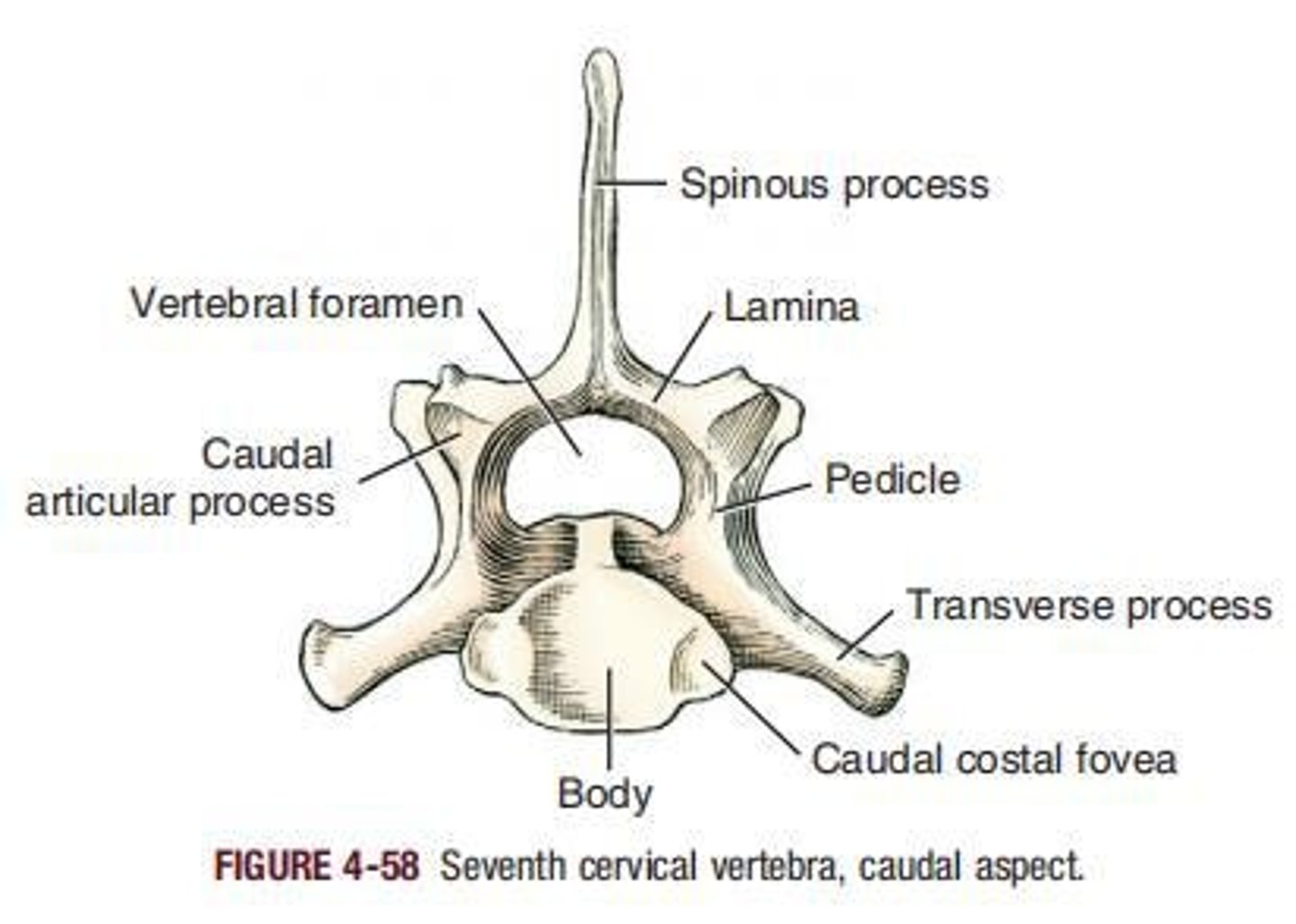 <p>Lacks transverse foramina, highest spinous process.</p>