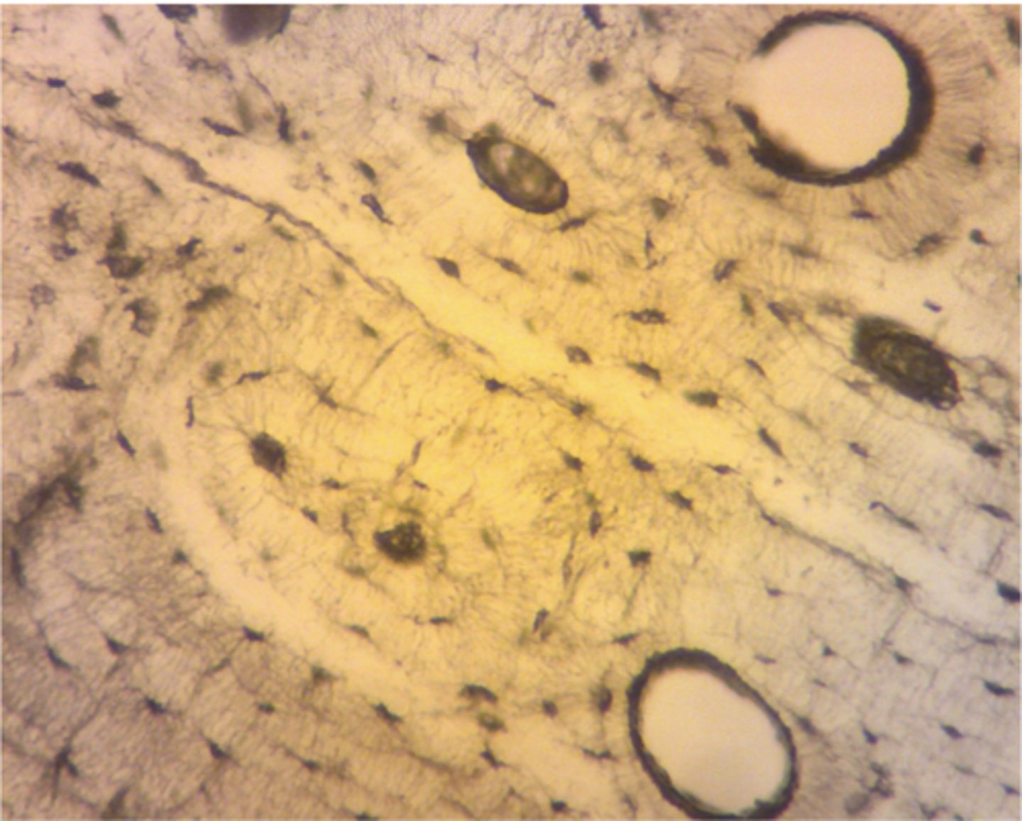 <p>Based on your experience in the histology lab, examine the image below and identify the correct tissue and correct rationale.</p><p>a. bone, based on the presence of osteoblasts</p><p>b. skin, based on the large blood vessels present in the hypodermis</p><p>c. neurons based on the presence of grey matter</p><p>d. liver, based on visible portal triad along the edges of the hepatic lobules</p>