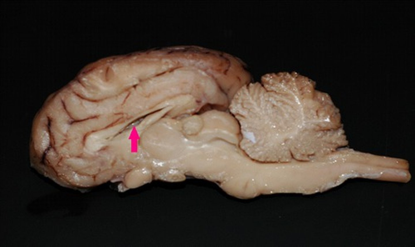 <p>Identify the membrane.</p>