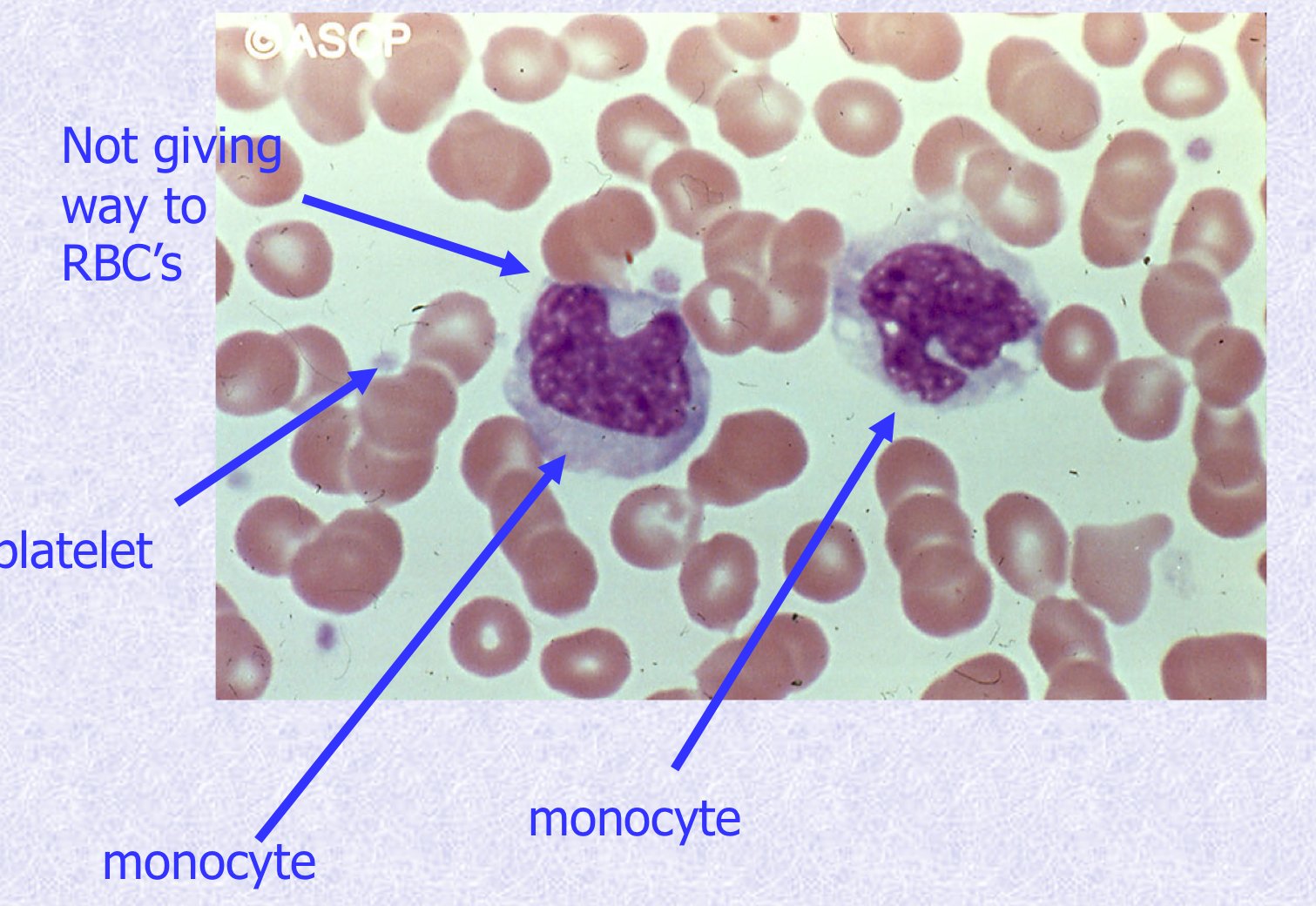 <p>What cell type is shown?</p>