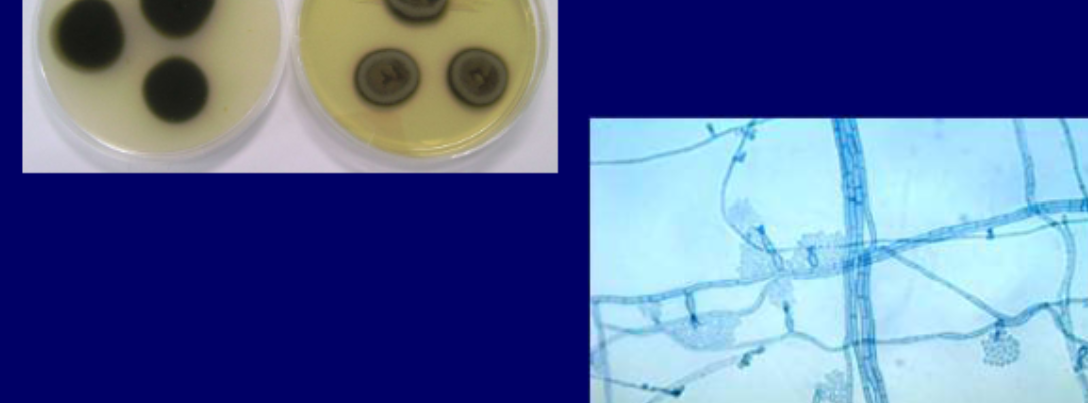 <p>Micro: phial flask shaped phialospores, phialoconidia clustered at phialide tips</p><p>Macro: olive-green-black obverse, olive-green-black reverse</p>