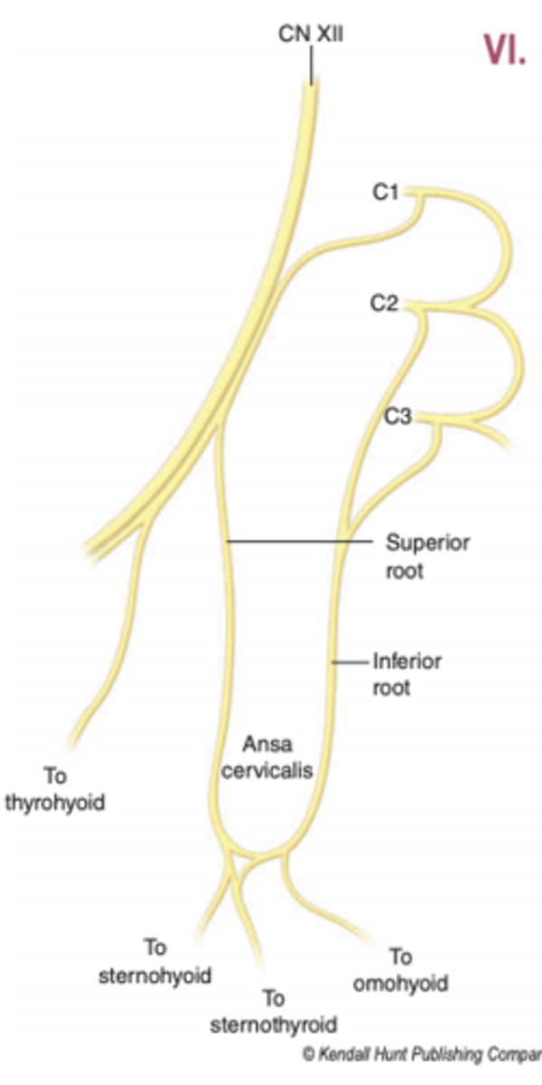 <p>C1</p>