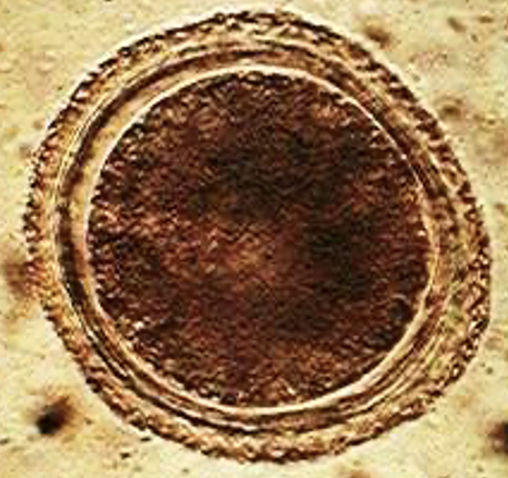 <p>Give the genius, species and common name for this <strong>feline </strong>parasitic egg</p>