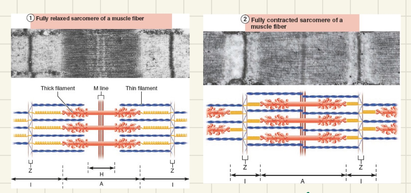 <p>-I bands shorten</p><p>-Z discs become closer</p><p>-H zones disappear</p><p>-A bands move closer to each other</p>