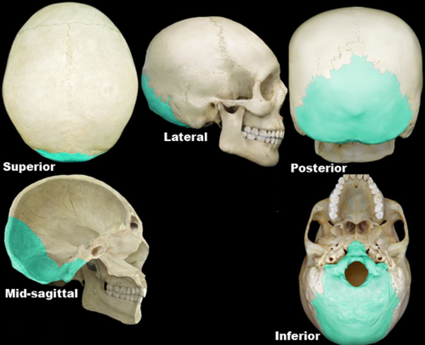 <p>thickest part of the skull</p>