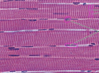 <p>Identify this muscle & it’s defining features?</p>