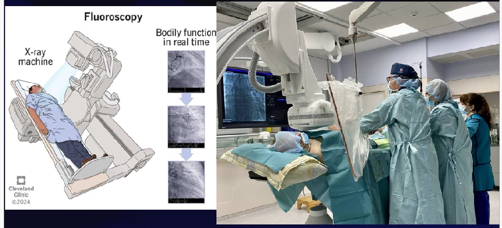 <p>It makes the shadows of x-rays visible, to provide real-time visualization of procedures. It exposes a patient to more radiation than routine radiography but often is used to guide needle biopsy procedures and nasogastric tube advanceme</p>