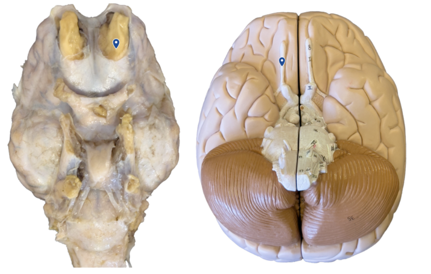 <p>What cranial nerve is the arrow pointing to?</p>
