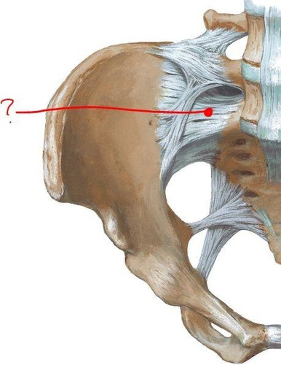 <p>strong, short, deep to dorsal ligament</p>