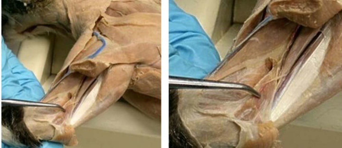 <p>What muscle is this?</p><p>Origin?</p><p>Insertion?</p><p>Action?</p><p>Nerve?</p>