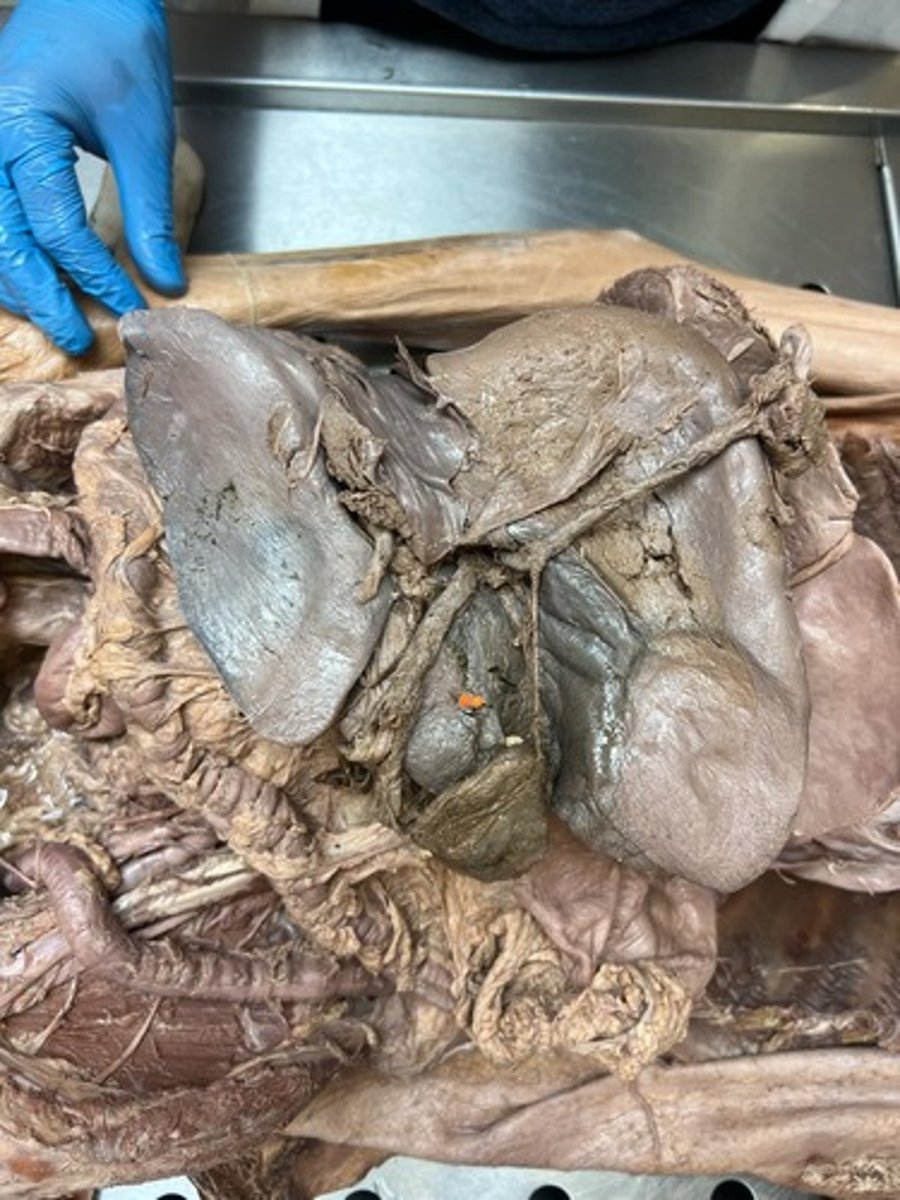 <p>quadrate lobe of liver</p>
