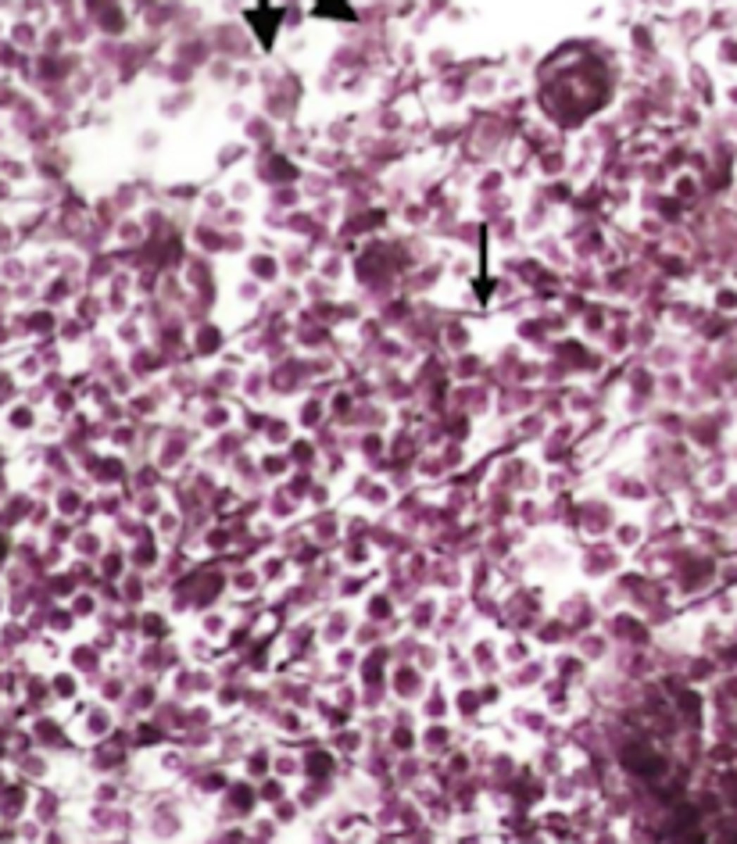 <p>Where is this type of tissue located in the body?</p>