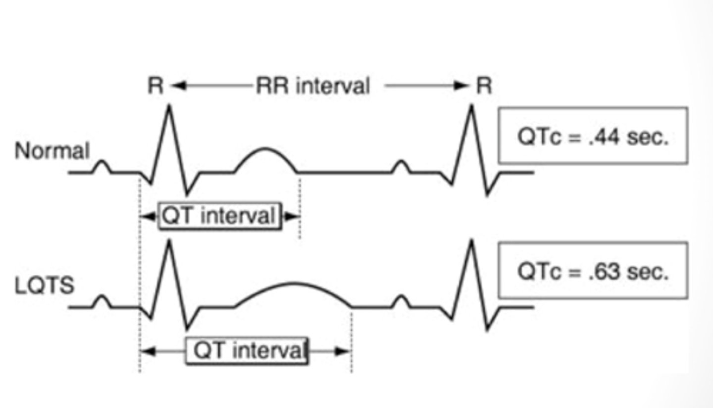 <p>↑ QT-interval</p><p>- Lead II or V5/V6</p>