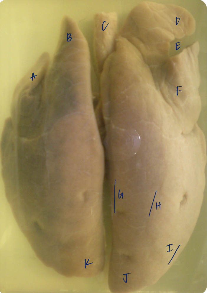 <p>K </p><p>(pig lungs, dorsal)</p>